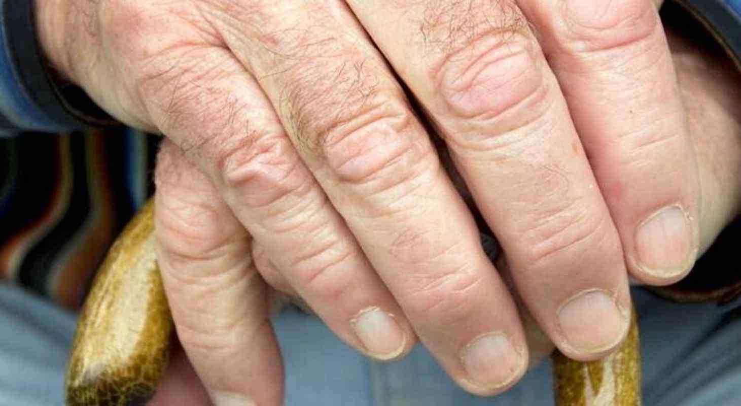 Idade mínima de aposentadoria após a reforma da previdência