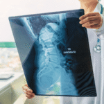 doenças na coluna que mais aposentam